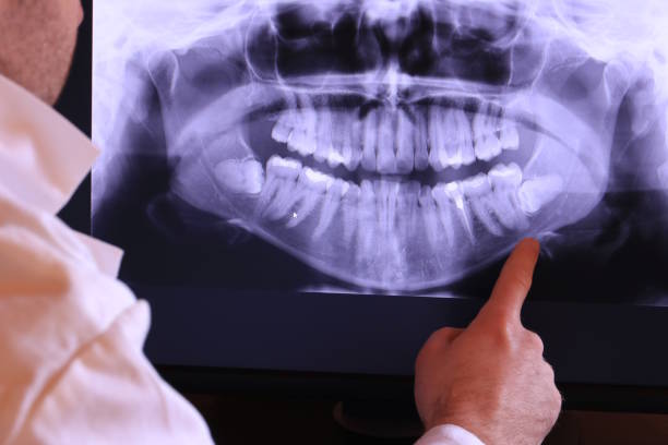 Best 24-Hour Emergency Dental Care in Glassmanor, MD
